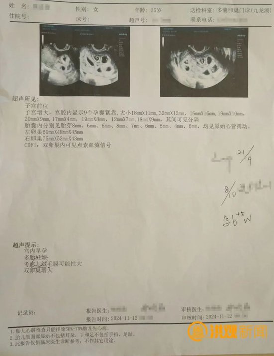 怀上九胞胎女子丈夫回应:决定减胎