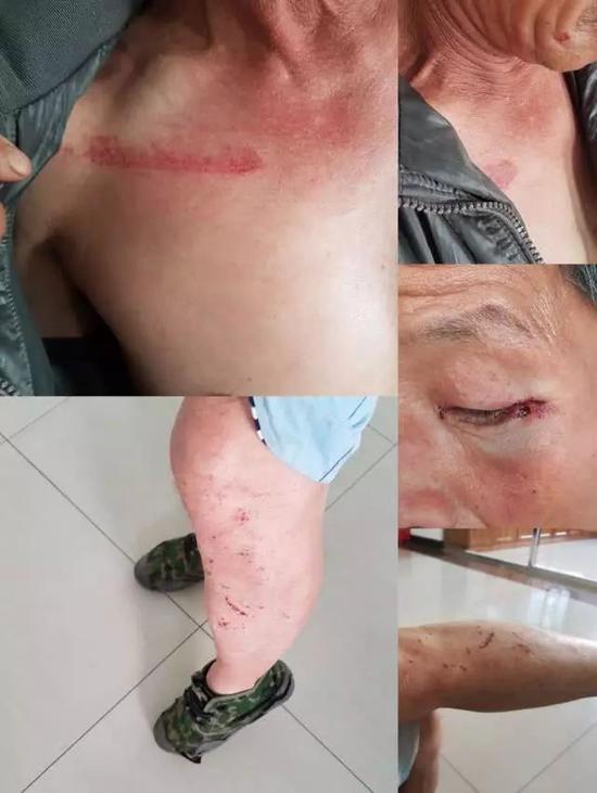 柔道冠军举报村支书贪腐村支书他们骚扰报复