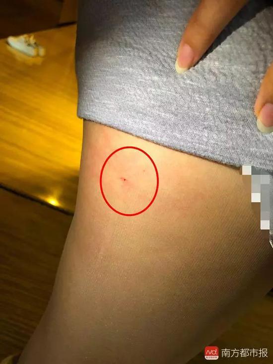 女子被床上立起的针扎出血 星级酒店称免房费(图)