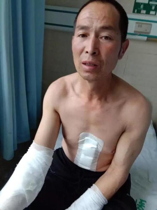 ▲2018年7月，小雨父亲王新元在涞源当地医院接受治疗。受访者供图