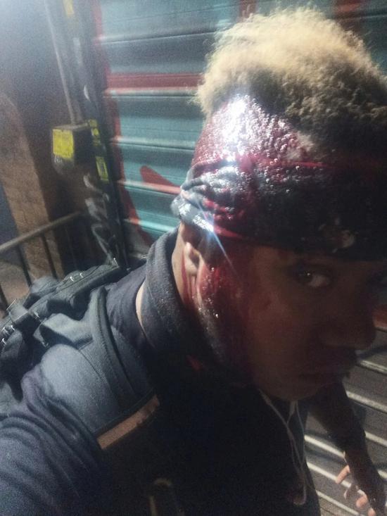 瓦伦丁头部受伤(图片由瓦伦丁提供)