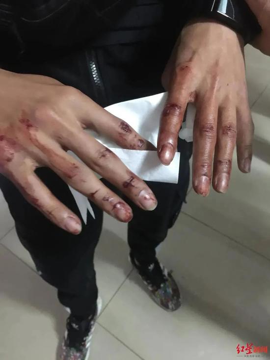 公路截击毒贩嫌疑人疯狂反抗撞坏7辆车10余民警受伤