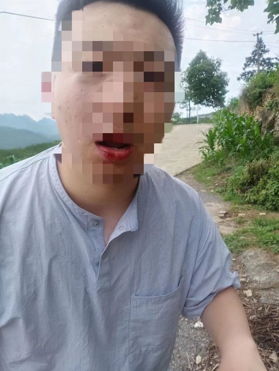 記者回應畢節採訪教師溺亡遭毆打：已通過照片辨認嫌疑人 - 新浪香港