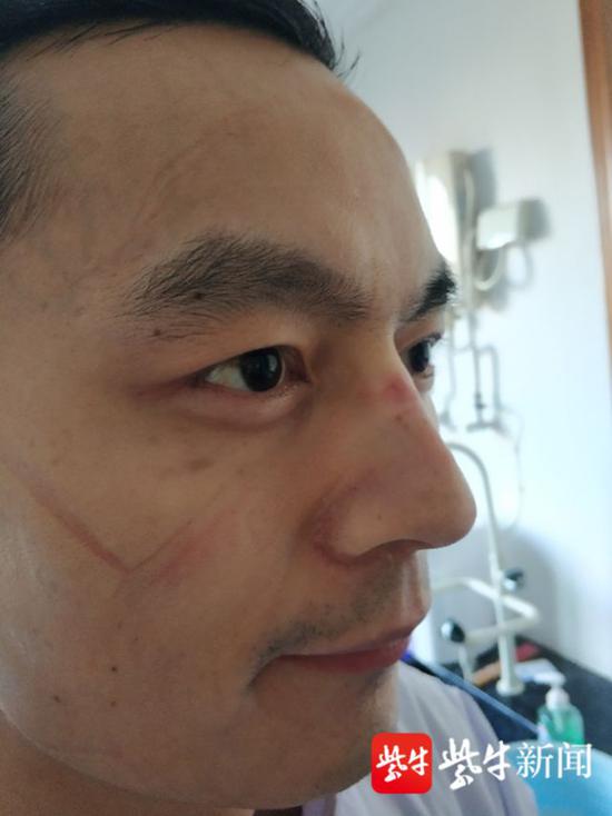 在黄石，我们一天和病毒“交手”362次！