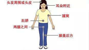 虫子一家:老人被这种虫子叮咬 一家四口接连发病两人去世
