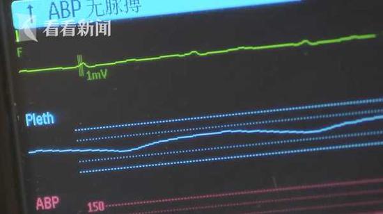 一场小感冒致37岁女子心脏骤停 抢救了159个小时