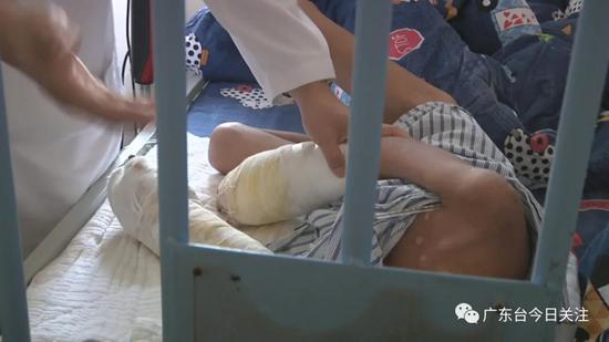 7岁男童满身烟头烫伤疤双手面临截肢 疑凶是亲生