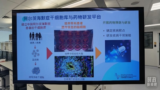 △香港神经退行性疾病中心在阿尔茨海默病诊断治疗方面的研究展示。（总台央视记者马亚阳拍摄）