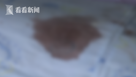 陈大姐说,这不是第一次家暴,她有点受不了了,很痛苦。