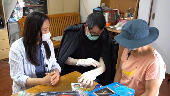 伤情反复！遭暴徒烧伤的李伯需再进行两次植皮