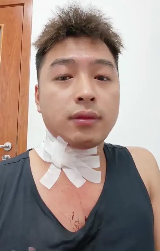 “医生，我不会死吧？”男子被蚊子叮咬颈部，流血一小时止不住，当事人最新发声