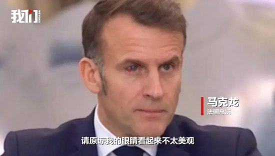 法国总统马克龙又被家暴了？右眼充血引猜测，此前被老婆当众“打脸”，否认夫妻关系不和，称“就是个玩笑”