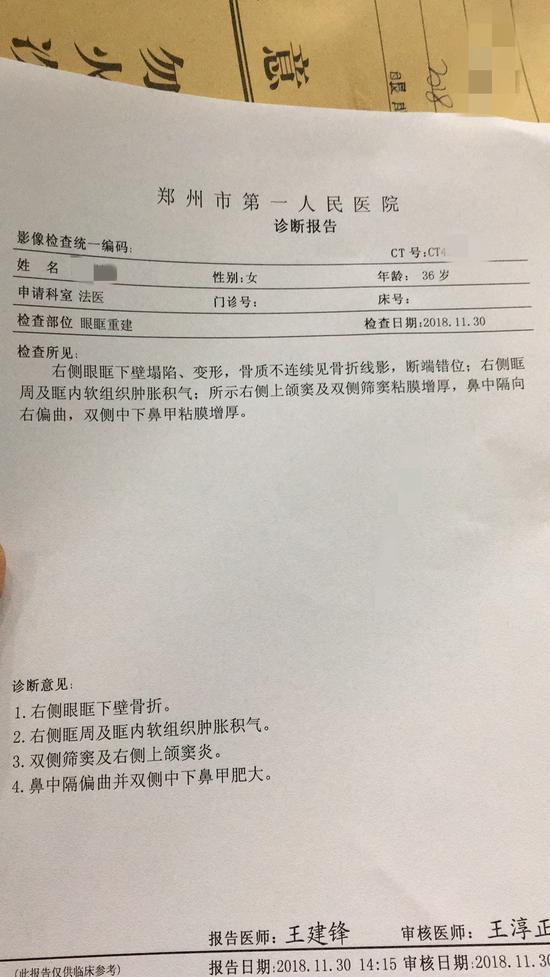 今年11月29日,潤妍遭到冀學家暴,致眼眶骨折。