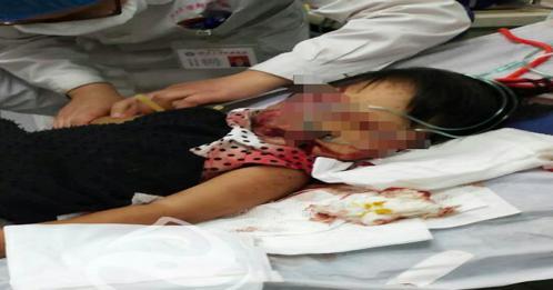 河北司机载老板遇车祸 对方家属持铁锹把3岁女儿打进ICU