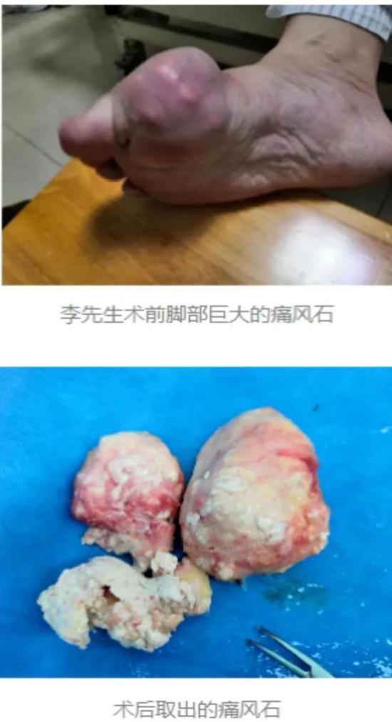 羊城晚报|广东男子穿人字拖爬雪山？这一“神操作”竟是因为……