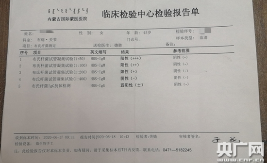 兰州肝功能检查
