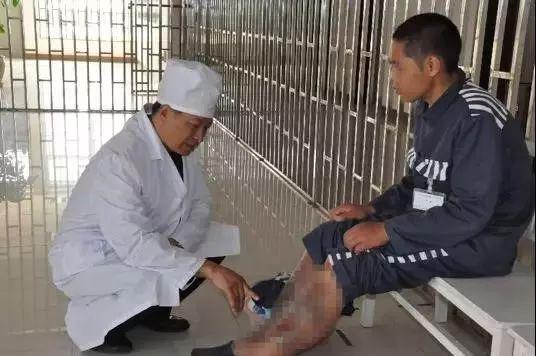  唐顺保看治病人腐烂的腿李明/摄