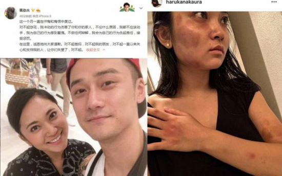 · Jiang Jinfu’s ex-girlfriend Zhongpu Youhua posted a picture of being domestically assaulted (pictured on the right). Jiang Jinfu soon posted an apology on Weibo (pictured on the left).