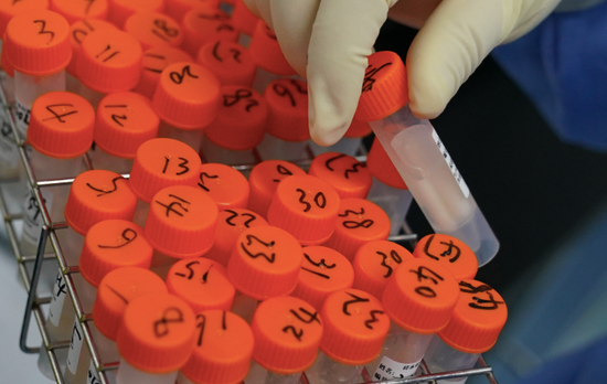 北京日报揭秘“病毒猎手”：面临气溶胶传染风险，做梦都在数数