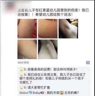 针扎事件:河北沧州红黄蓝再曝针扎幼童事件 掌掴老师