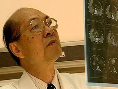 癌症肿瘤:肿瘤院士研究癌症一辈子 却劝人别轻易开刀
