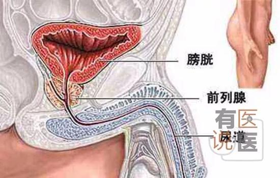 吸毒男子把锁头从尿道塞进膀胱医生拍片后吓一跳