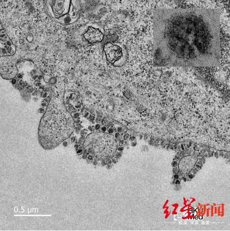 培养48幼时后的冠状病毒电子显微镜图像