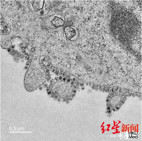 新式冠状病毒在细胞中滋长的电子显微镜图像