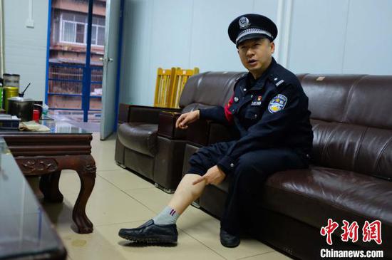 邹海指着自己脚上的伤疤，讲述缉逃故事。 覃建勋 摄