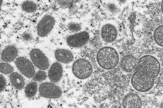 电子显微镜图像显示的成熟猴痘病毒（左）和未成熟病毒粒子（右）。（资料图）海外网5月24日电据美国《国会山报》报道，美疾控中心高后果病原体和病理学部门副主任詹妮弗·麦奎斯顿（JenniferMcQuis
