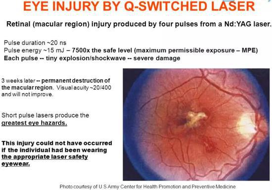 ▲激光安全教材普遍辅以兔眼受激光照射后的解剖图片。