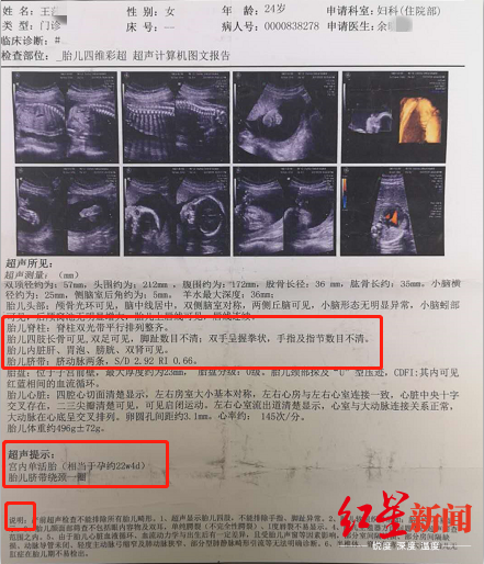 宫外孕报告单图片图片