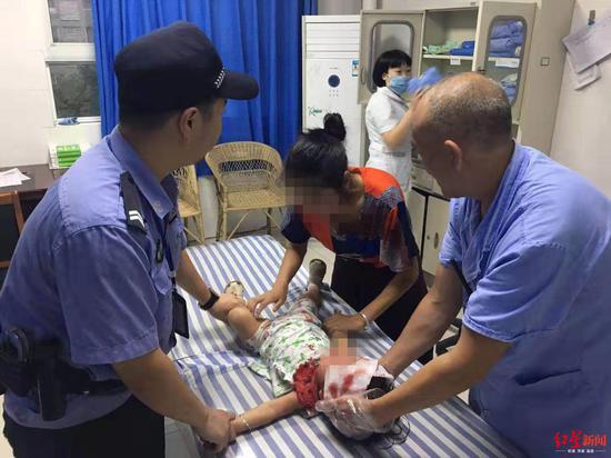 小女孩在醫院救治