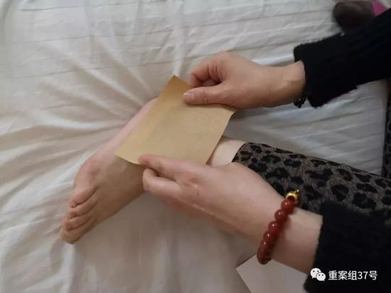 ▲2019年1月21日,布病患者正在病房里给自己贴药膏,她得了布病关节炎,脚踝经常疼痛。新京报记者 吴靖 摄