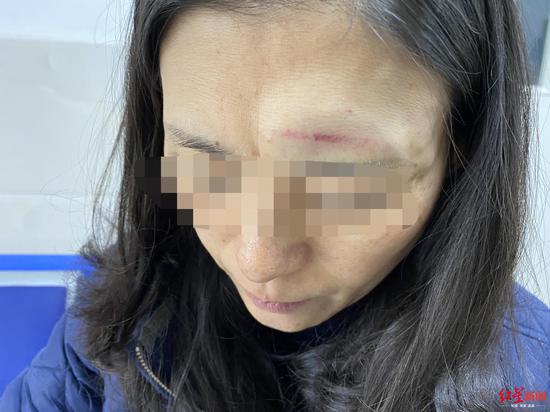 难忍楼上养狗噪声 男子持辣椒枪喷向邻居全家
