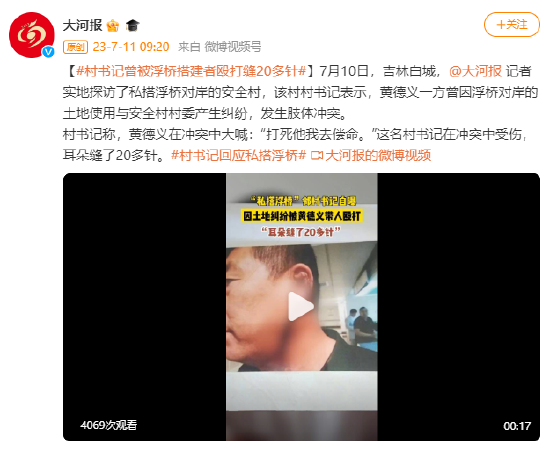 胃和耳朵，哪个和晕车关系更大？