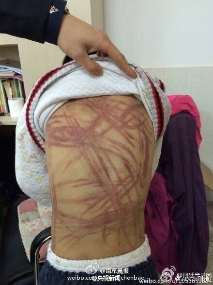 南京虐童案二审将开庭 养母请求改判无罪