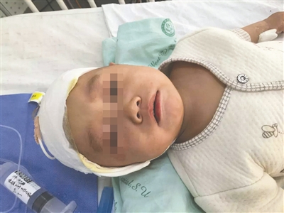 小林已基本度过术后的感染关。图片由医院提供