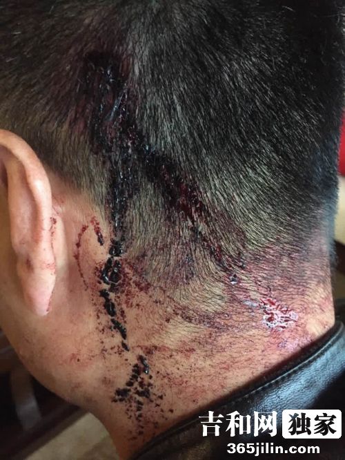 长春人在三亚买超两千万期房过期不交房 维权被打头破血流