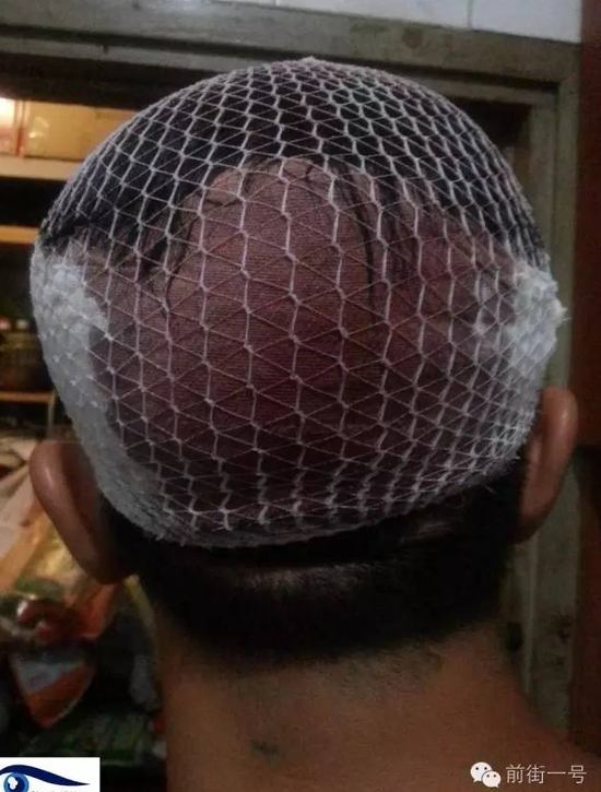 妻子疑丈夫外遇带人捉奸 3人被丈夫持刀砍伤