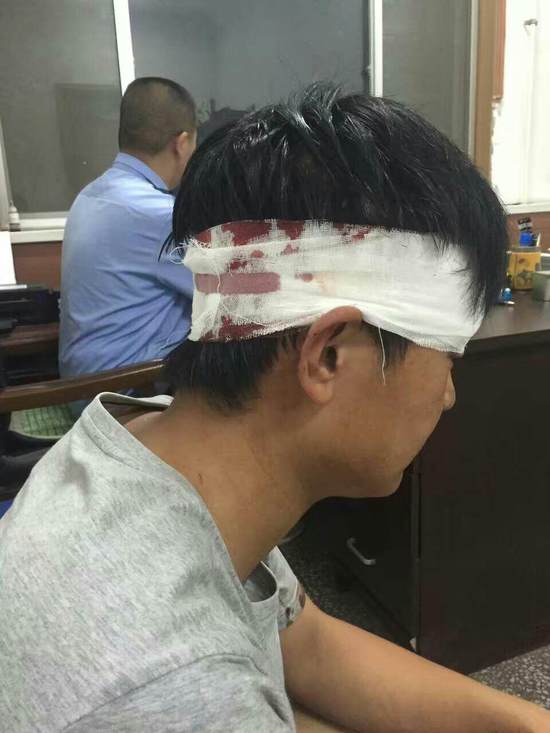 男子为小贩鸣不平遭城管殴打