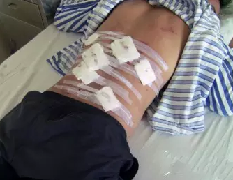 近30名初中生携带管制刀具争斗 多人受伤