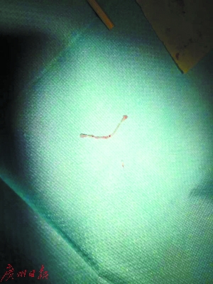 　　细细的虫子，看来有些骇人。