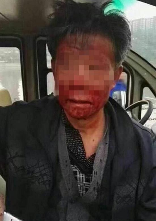 (记者 范丽芳 屈丽霞)10月31日,有网友发帖称,山西省临汾市襄汾县环保