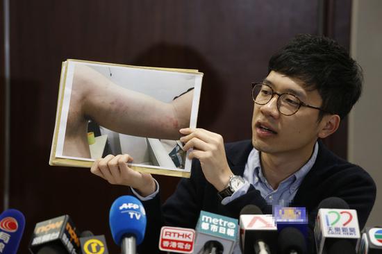 罗冠聪开记者会控诉自己被打