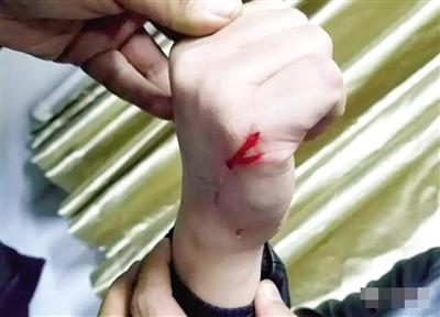 "女老赖"抓伤法官:宁愿坐牢也不愿还钱