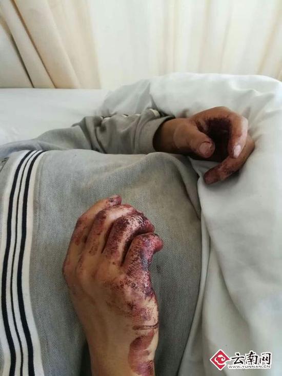 冲突后员工被打伤