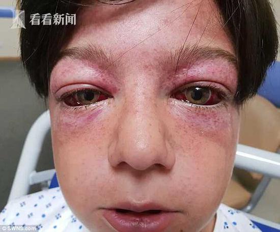 男孩玩死亡转盘脑损伤医生宇航员经历这个