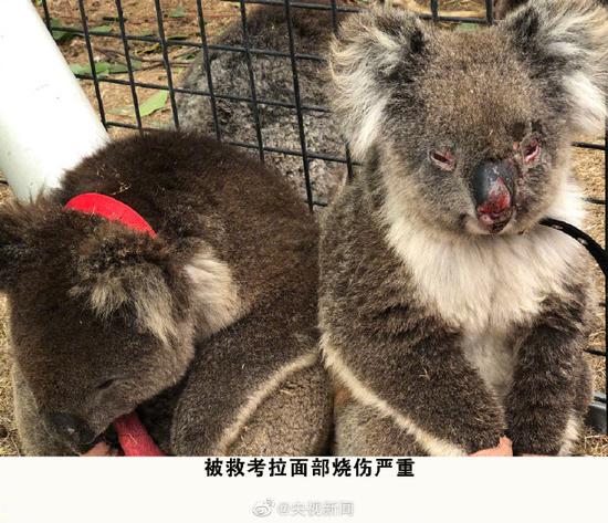 被救考拉面部烧伤严重
