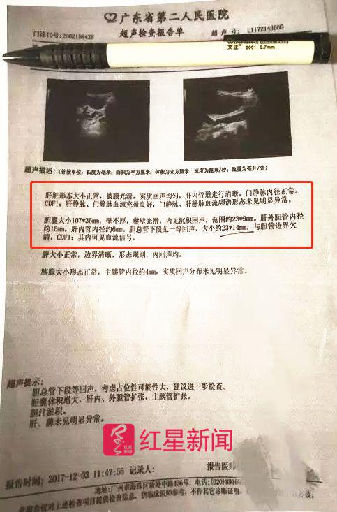 红星新闻对比发现,美年富海门诊部体检报告中"胆"检查项与广东省第二